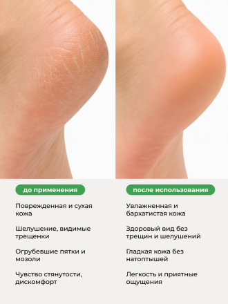 MANITA   Крем для ног   С МЕНТОЛОМ И КАМФОРОЙ   500мл   {7726}