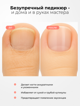 MANITA   Нано Лезвие С МОЧЕВИНОЙ 25%  100мл   Кератогель для педикюра   {7730}